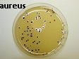 staph aureus